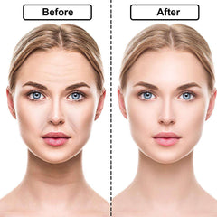 Reusable Facial Anti-Wrinkle Face Gel Pad